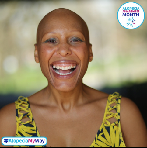 Alopecia UK Beauty